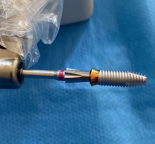Implant perio level monté sur le porte implant